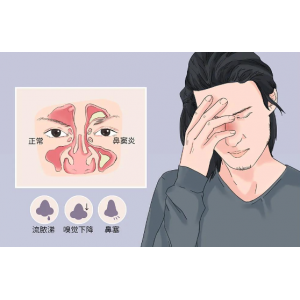 為什么感冒容易導致鼻竇炎，鼻竇炎該如何預防？