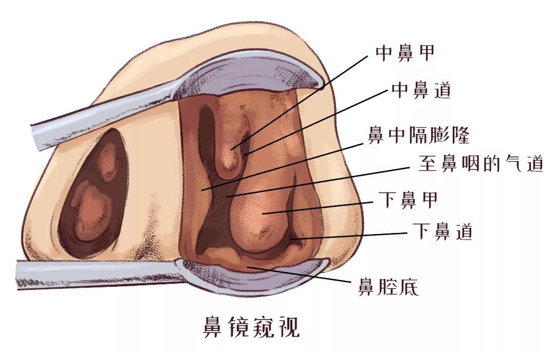 鼻甲肥大引起的呼吸困難怎么辦？(圖2)