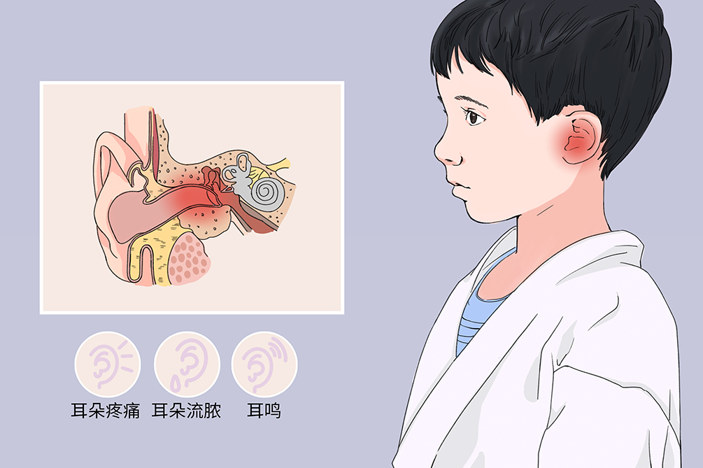 中耳炎雖小，但其危害不容小覷！(圖1)