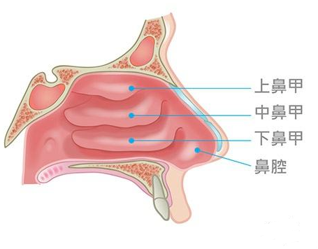 鼻甲肥大會(huì)引起面部結(jié)構(gòu)變化，還會(huì)導(dǎo)致眼袋、黑眼圈？(圖1)