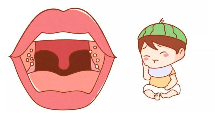 切除扁桃體會對身體產(chǎn)生危害嗎？(圖3)