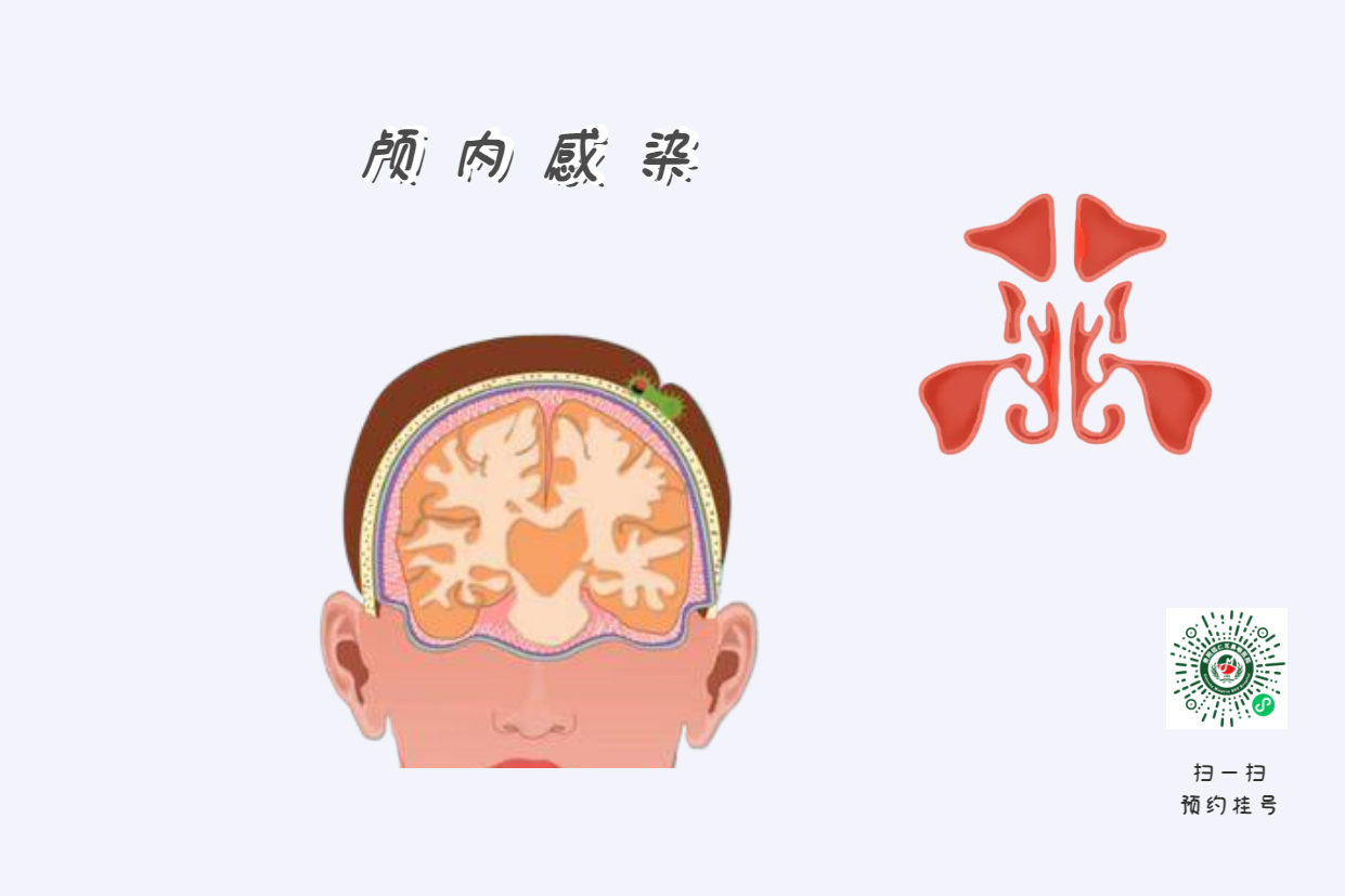 鼻竇炎為什么會(huì)頭痛？(圖1)