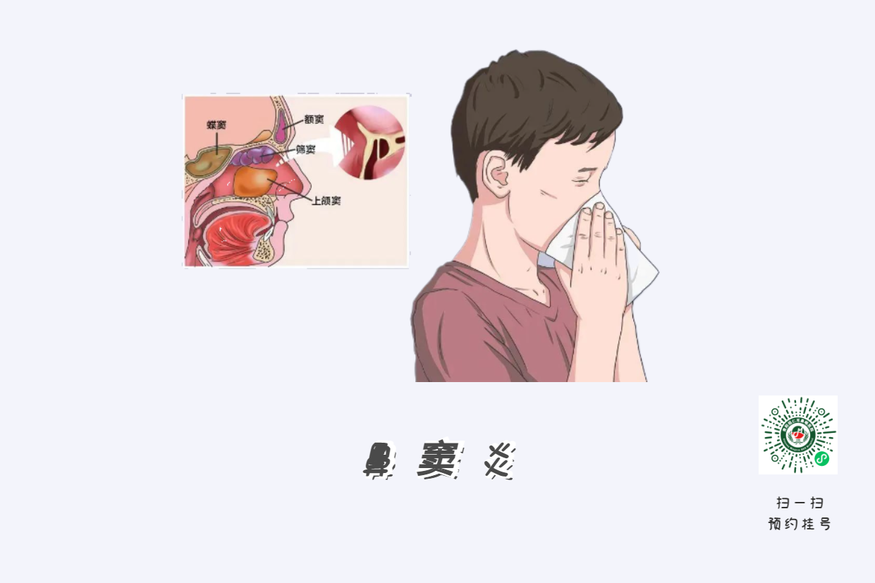 鼻竇炎為什么會(huì)頭痛？(圖2)