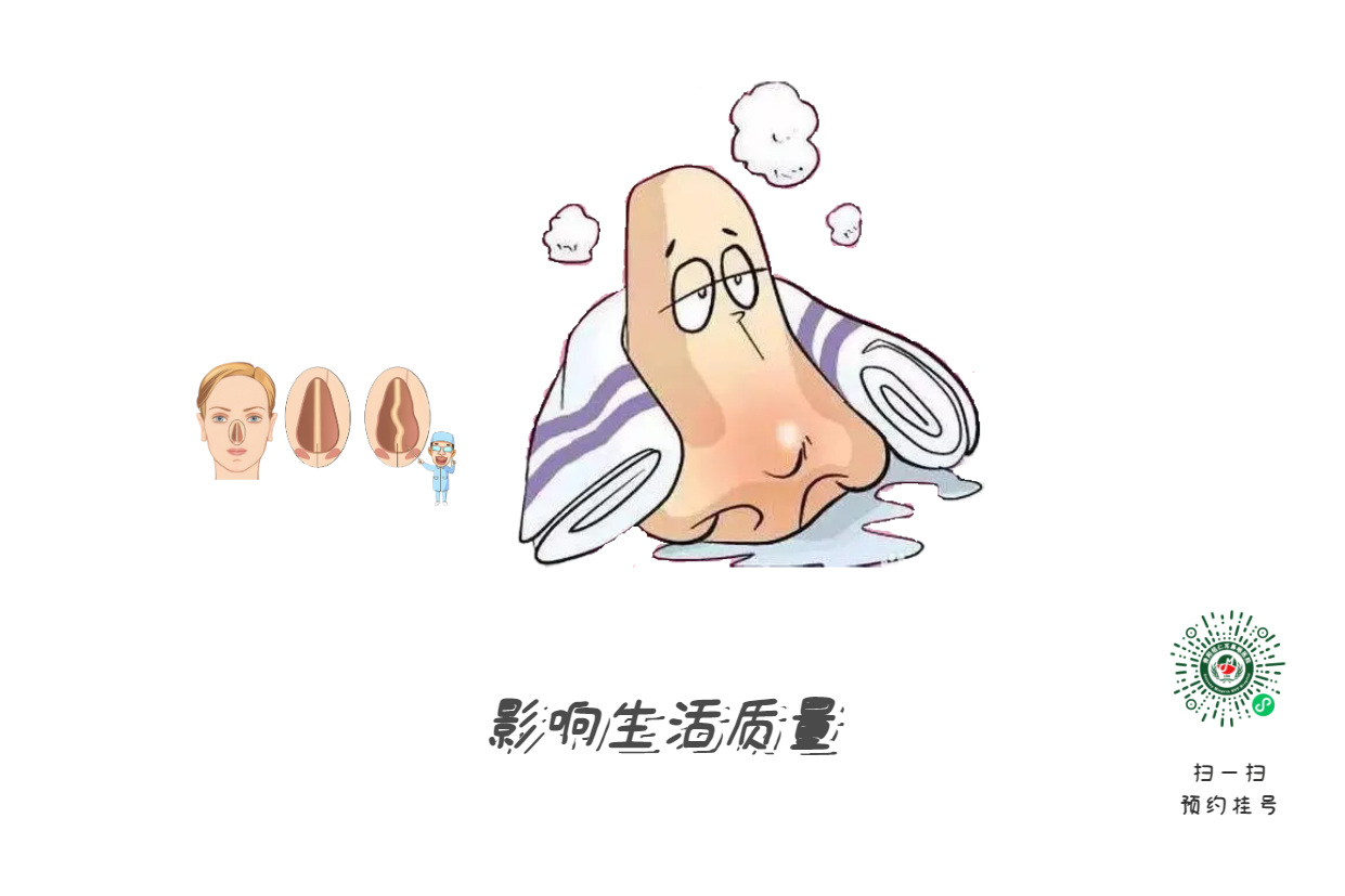 鼻塞、流涕、打噴嚏，是鼻炎引起的？注意可能是鼻中隔偏曲！(圖2)