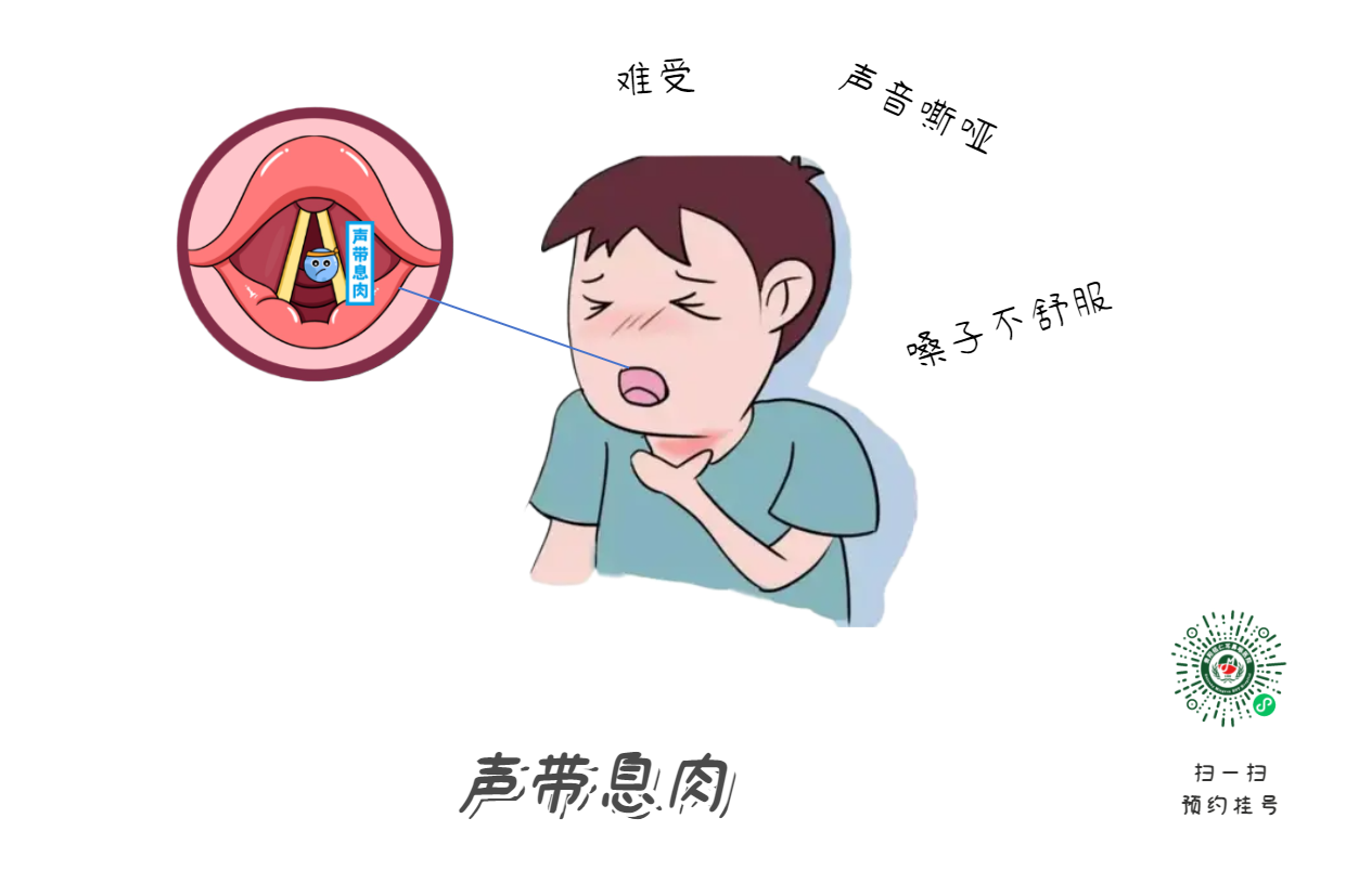 聲音嘶啞，喉部不適怎么辦？怎么預(yù)防？(圖1)