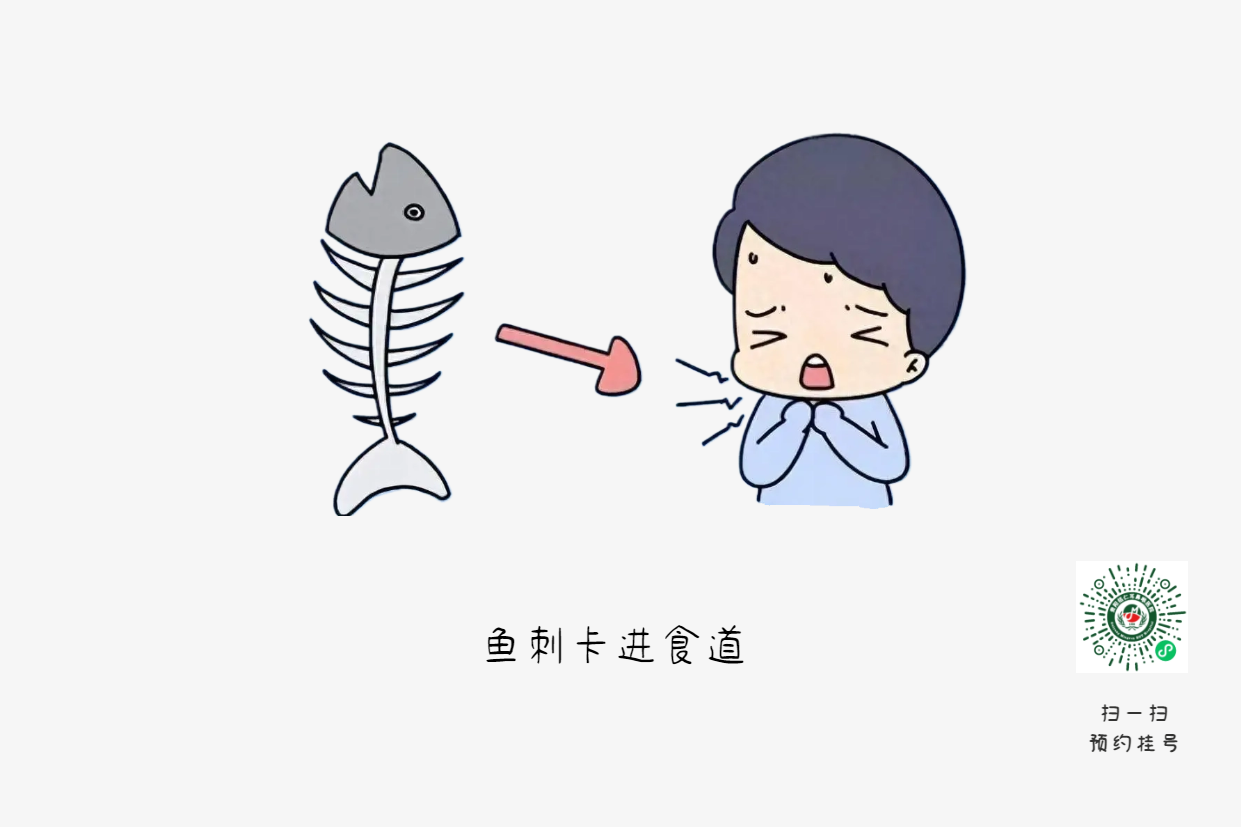魚刺卡喉時，你的“土方法”可能讓情況更危險(圖1)
