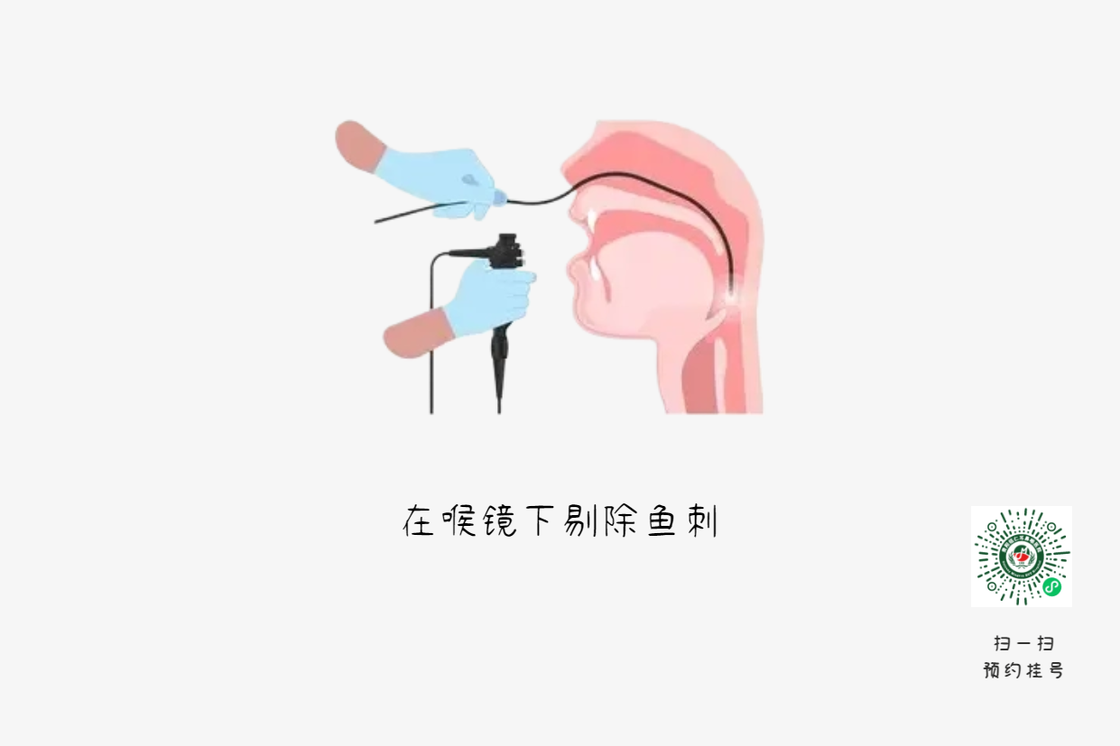 魚刺卡喉時，你的“土方法”可能讓情況更危險(圖3)
