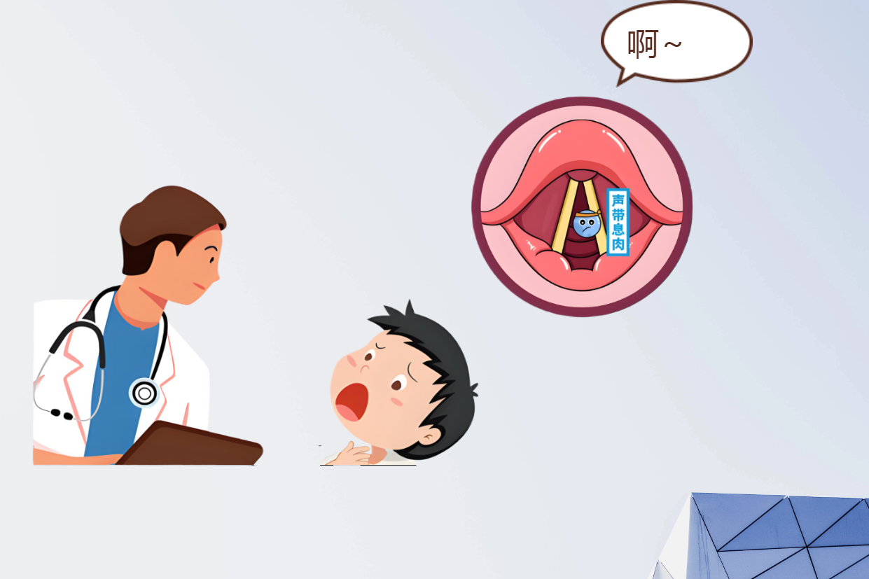 長(zhǎng)期清嗓子？可能是聲帶息肉早期信號(hào)(圖2)