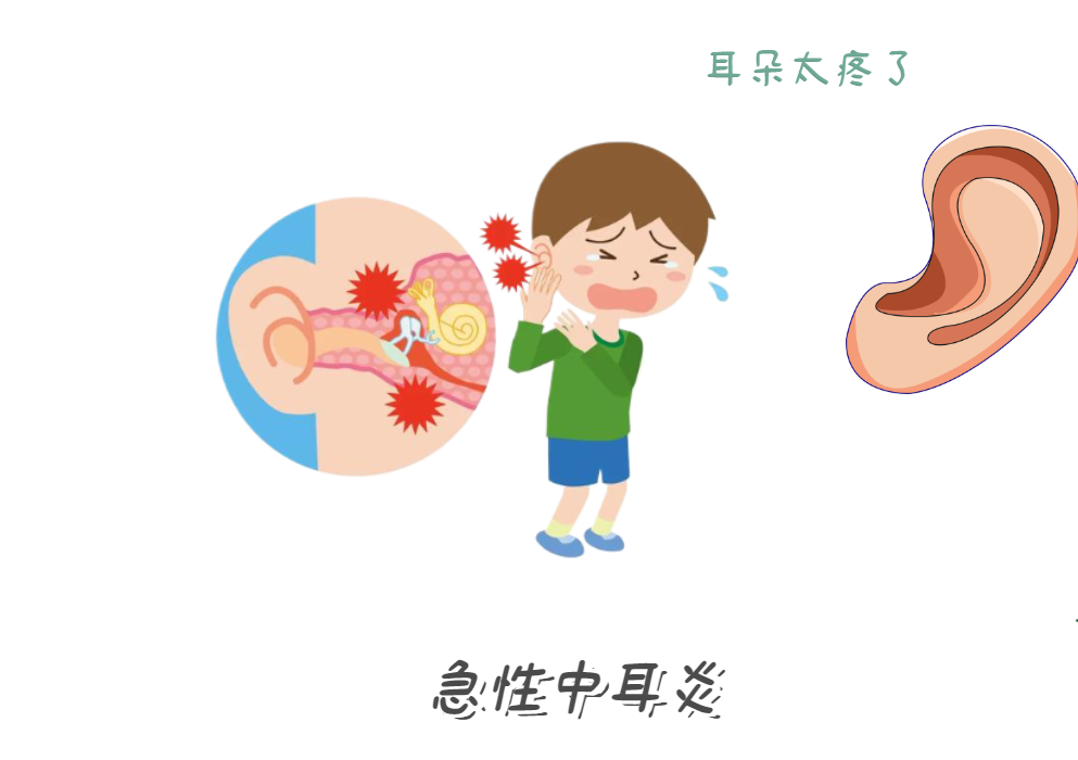 耳朵痛到睡不著？急性中耳炎急救法！(圖1)