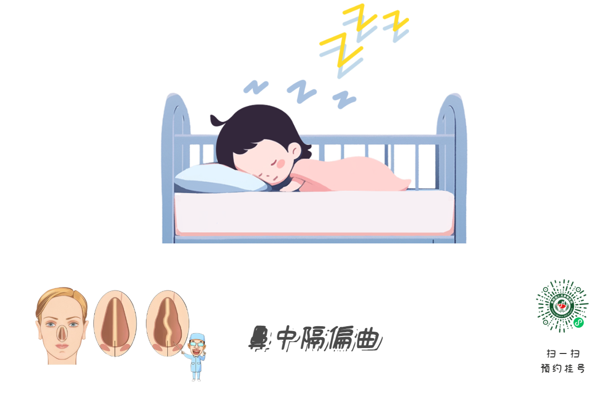 孩子打呼=睡得香？腺樣體警報(bào)！(圖3)